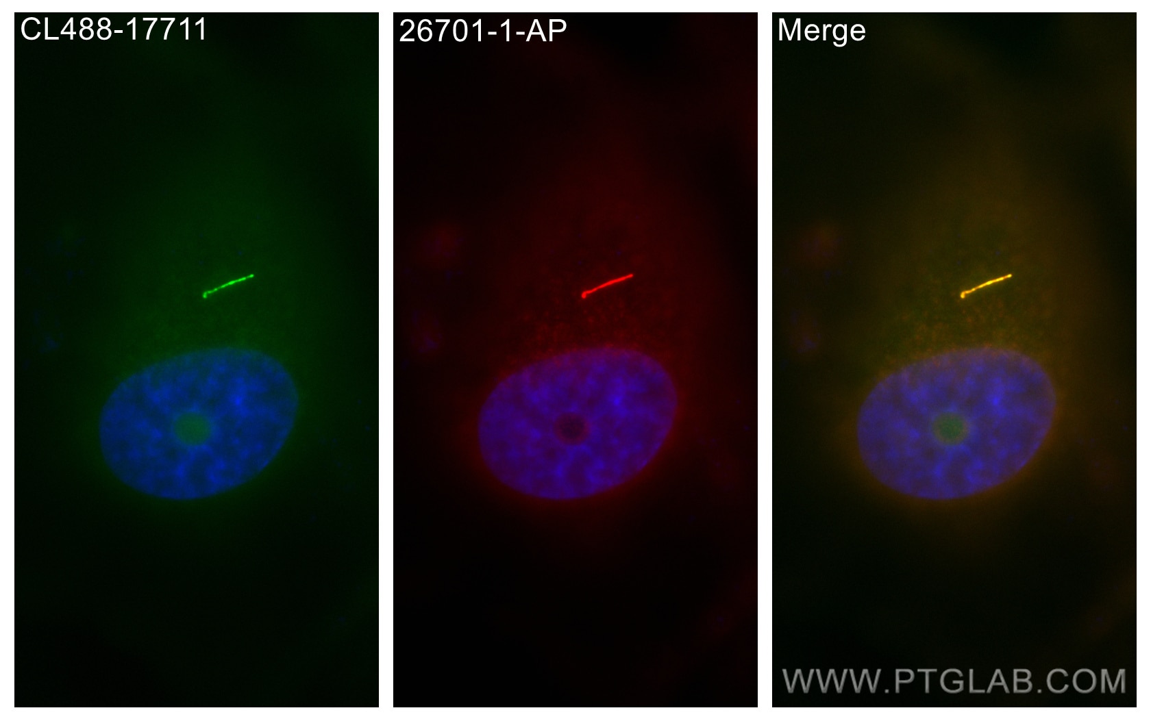 Immunofluorescence (IF) / fluorescent staining of MDCK cells using WDR35 Polyclonal antibody (26701-1-AP)