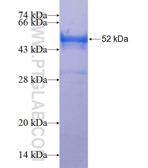 WDR35 fusion protein Ag24965 SDS-PAGE