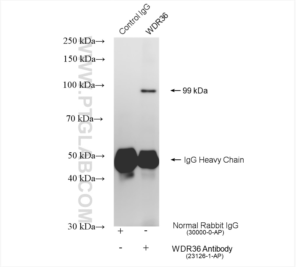 Immunoprecipitation (IP) experiment of mouse liver tissue using WDR36 Polyclonal antibody (23126-1-AP)