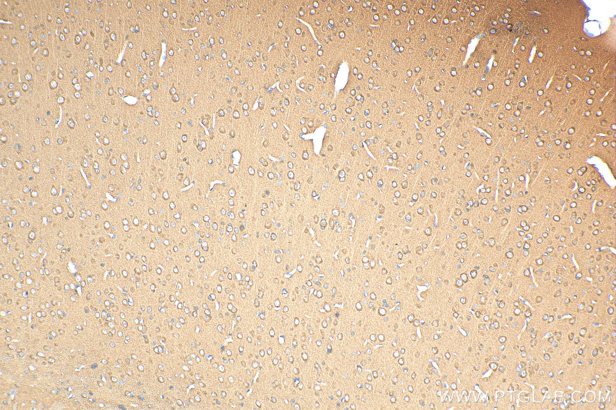 Immunohistochemistry (IHC) staining of mouse brain tissue using WDR37 Polyclonal antibody (20916-1-AP)