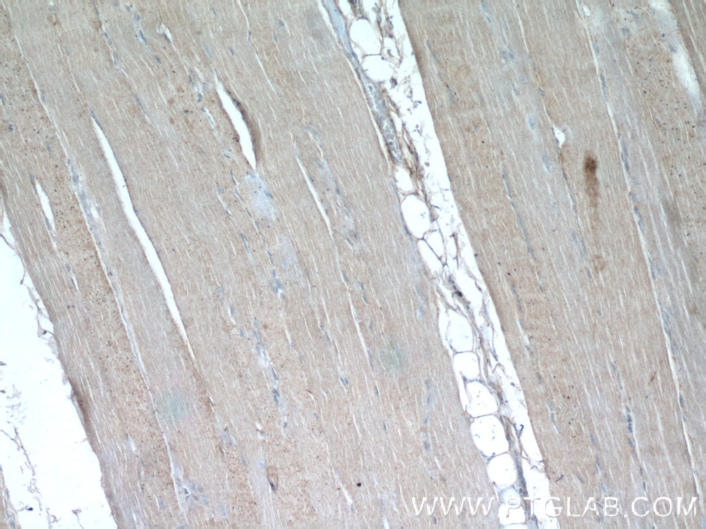 Immunohistochemistry (IHC) staining of human skeletal muscle tissue using WDR38 Polyclonal antibody (25683-1-AP)