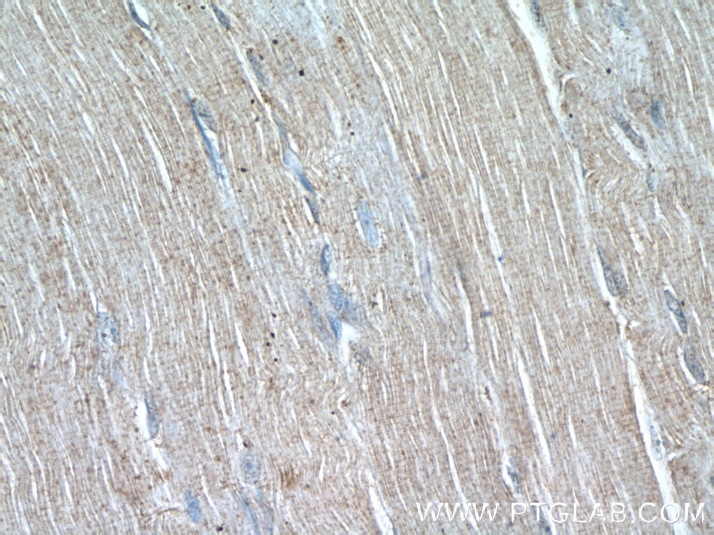 Immunohistochemistry (IHC) staining of human skeletal muscle tissue using WDR38 Polyclonal antibody (25683-1-AP)