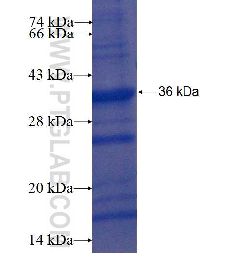 WDR38 fusion protein Ag22444 SDS-PAGE