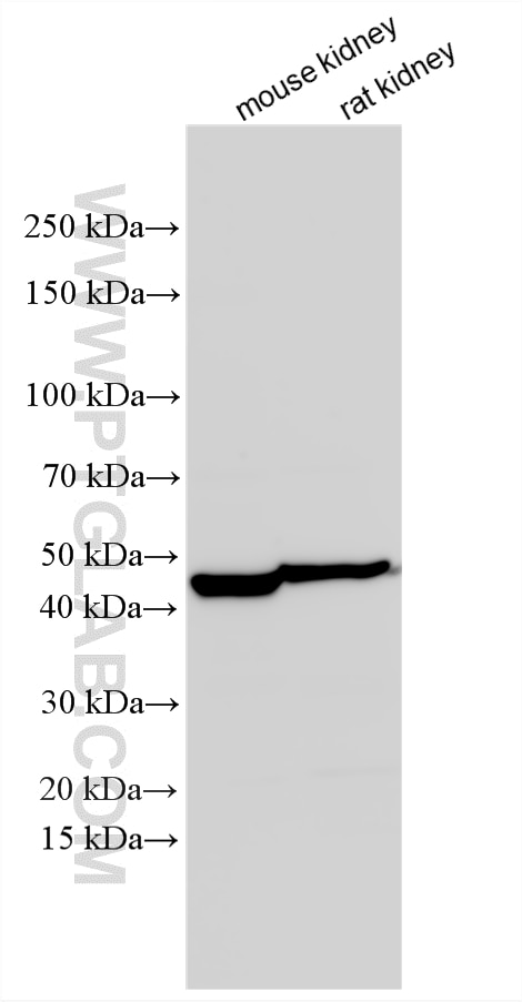 Western Blot (WB) analysis of various lysates using WDR4 Polyclonal antibody (30062-1-AP)
