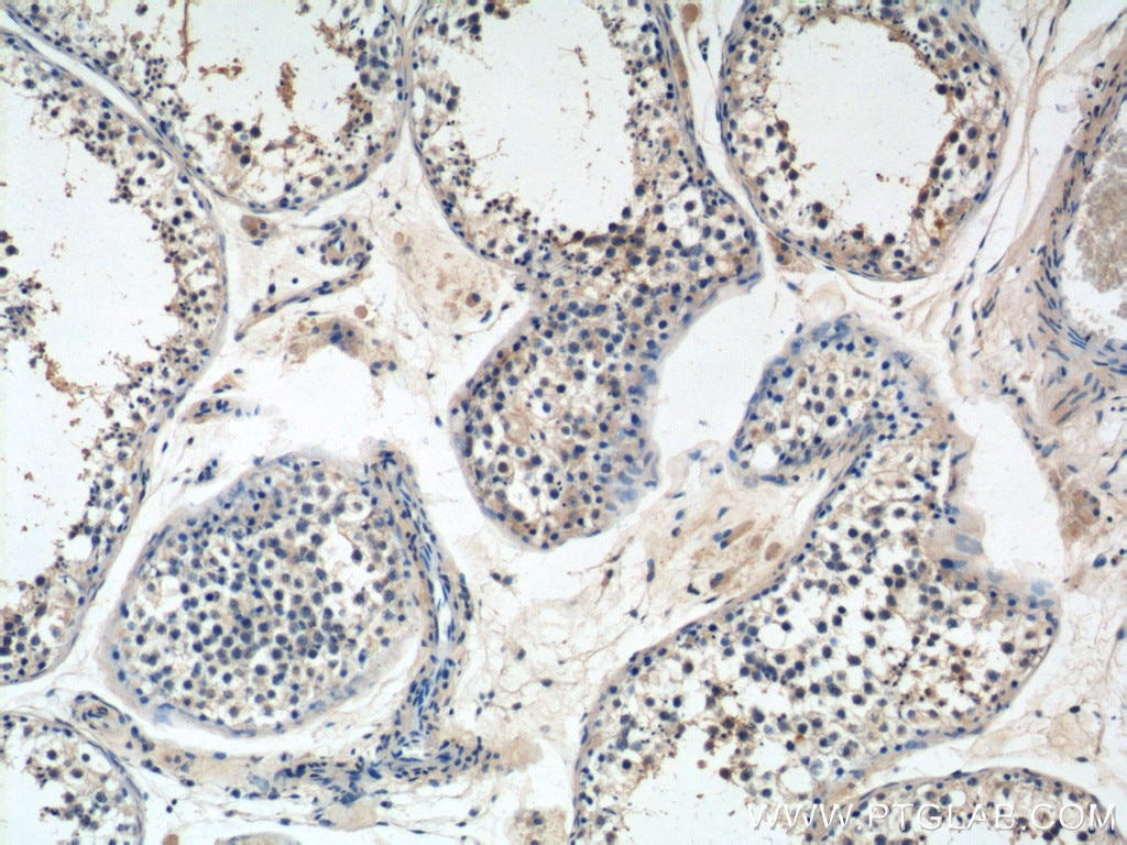Immunohistochemistry (IHC) staining of human testis tissue using WDR40A Polyclonal antibody (20478-1-AP)