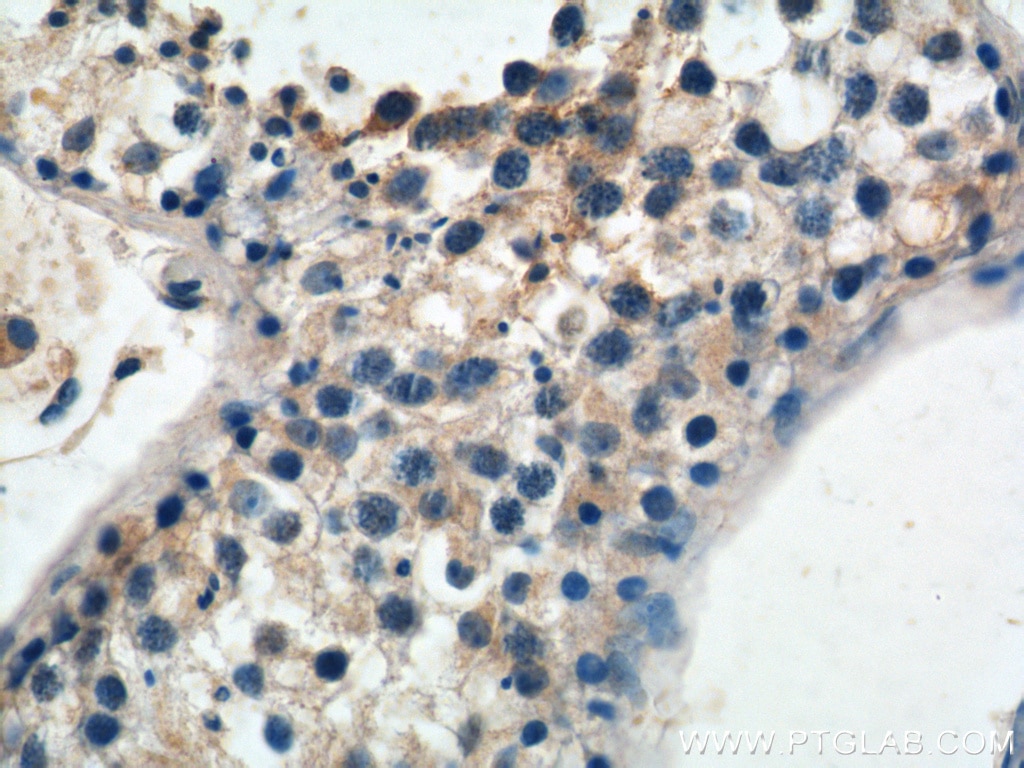 Immunohistochemistry (IHC) staining of human testis tissue using WDR40A Polyclonal antibody (20478-1-AP)