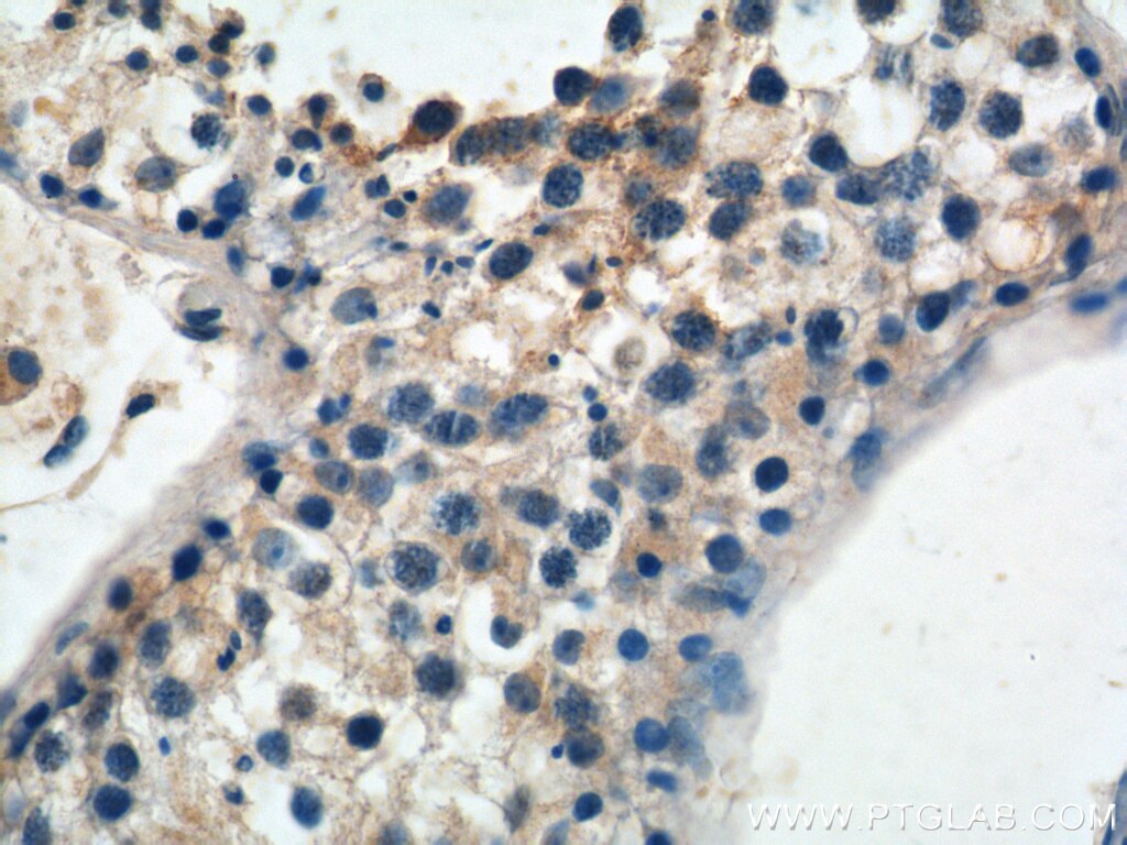 IHC staining of human testis using 20478-1-AP