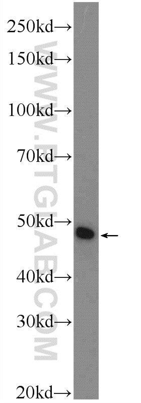 Western Blot (WB) analysis of Jurkat cells using WDR40A Polyclonal antibody (20478-1-AP)