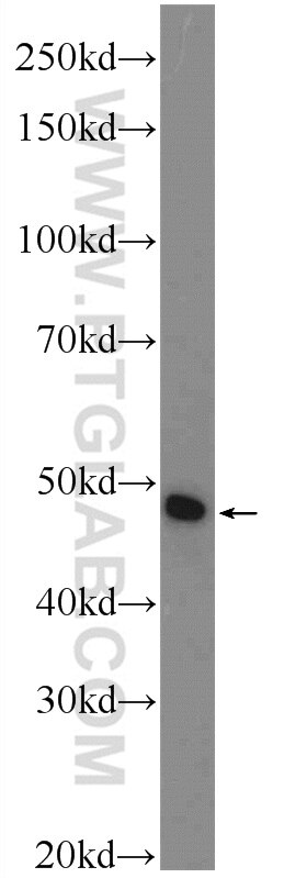 WB analysis of Jurkat using 20478-1-AP