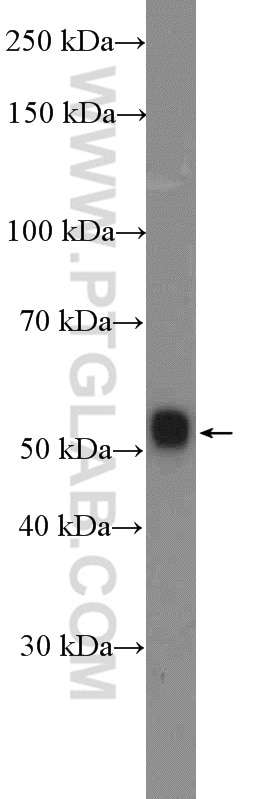 Western Blot (WB) analysis of fetal human brain tissue using WDR41 Polyclonal antibody (26817-1-AP)