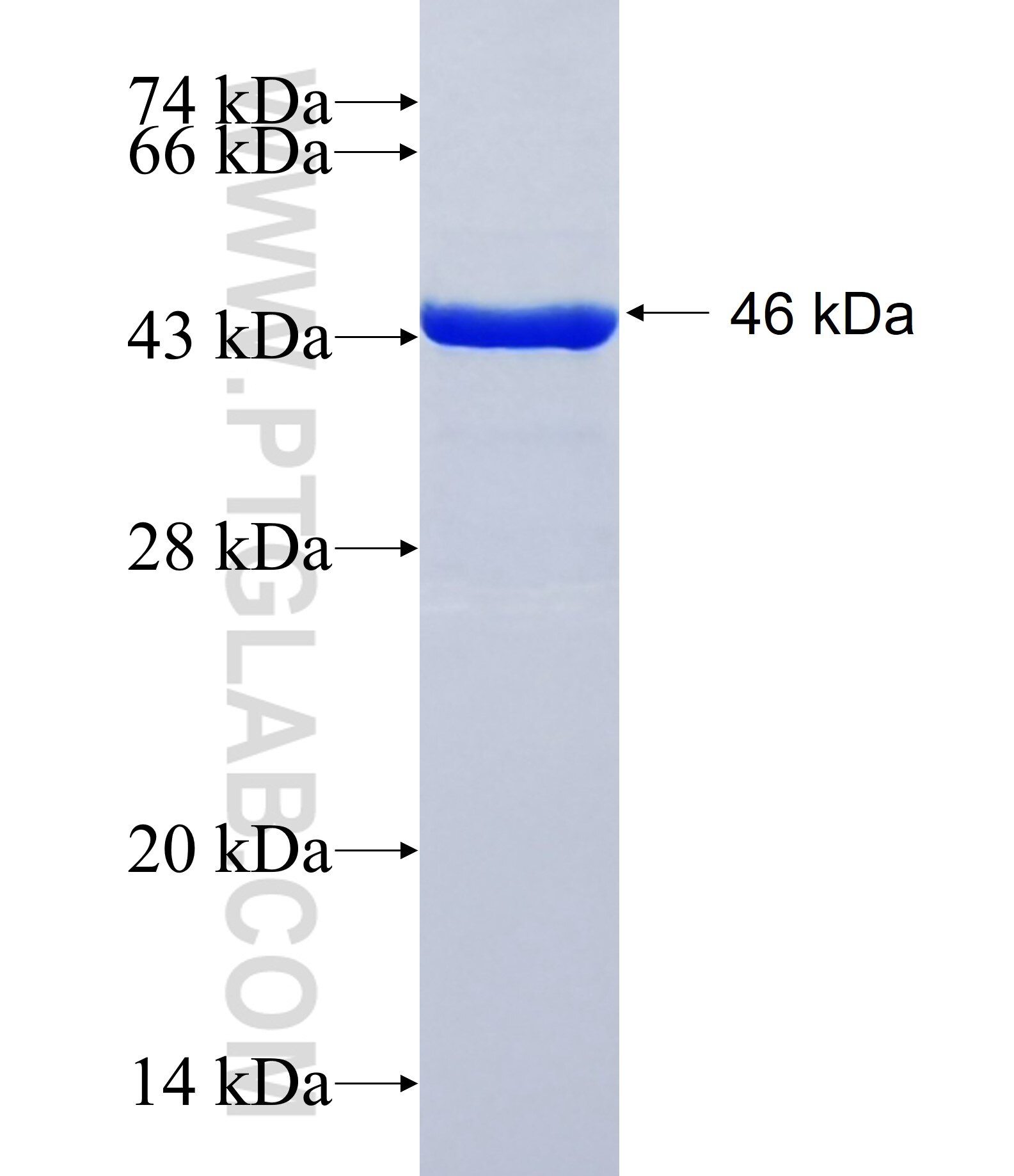 WDR42A fusion protein Ag38765 SDS-PAGE WDR42A fusion protein Ag38765 SDS-PAGE