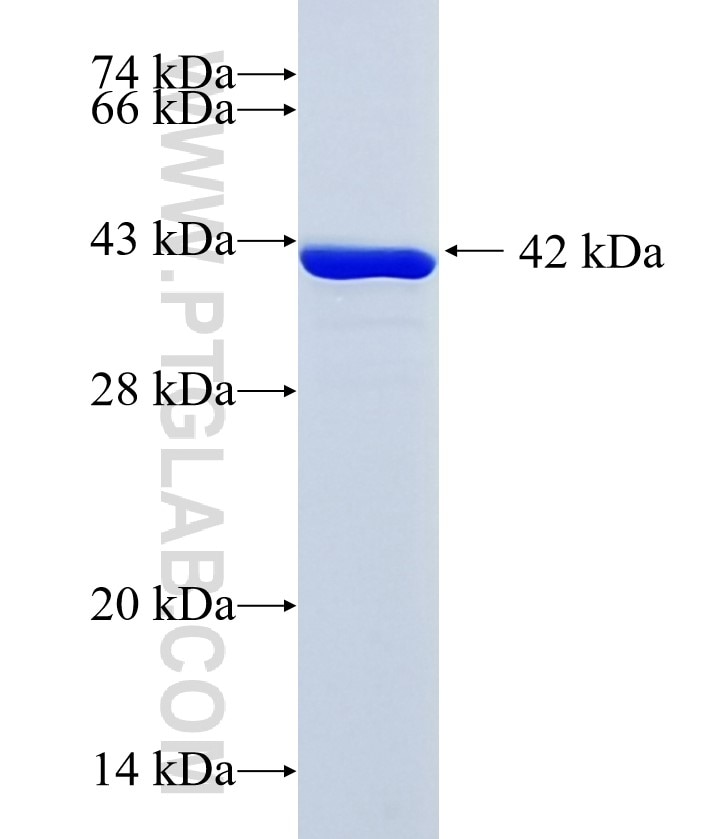 WDR42B fusion protein Ag36115 SDS-PAGE WDR42B fusion protein Ag36115 SDS-PAGE