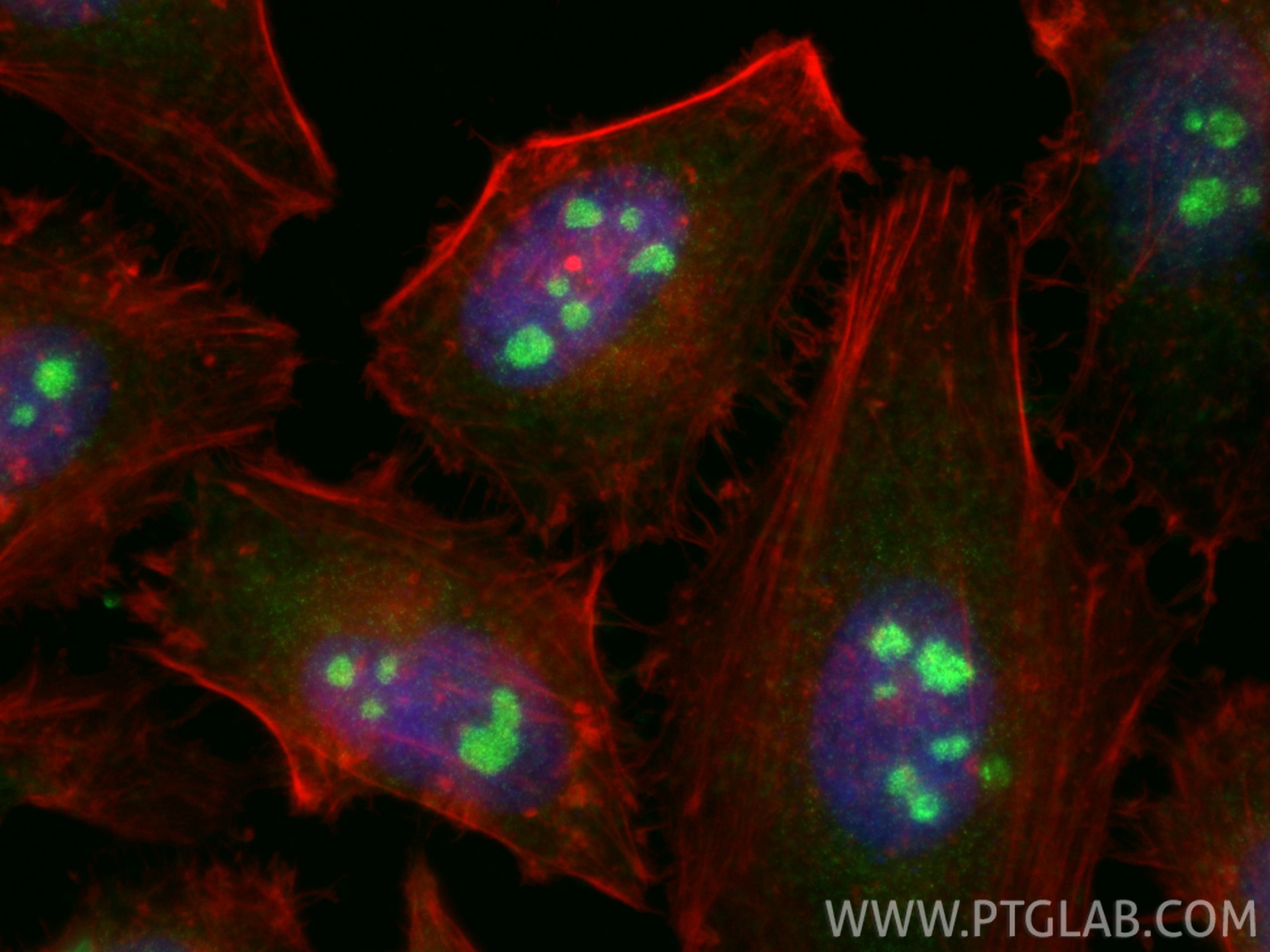 IF Staining of HeLa using 30227-1-AP Immunofluorescence (IF) / fluorescent staining of HeLa cells using WDR43 Polyclonal antibody (30227-1-AP)