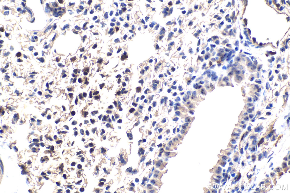 IHC staining of mouse lung using 30227-1-AP Immunohistochemistry (IHC) staining of mouse lung tissue using WDR43 Polyclonal antibody (30227-1-AP)