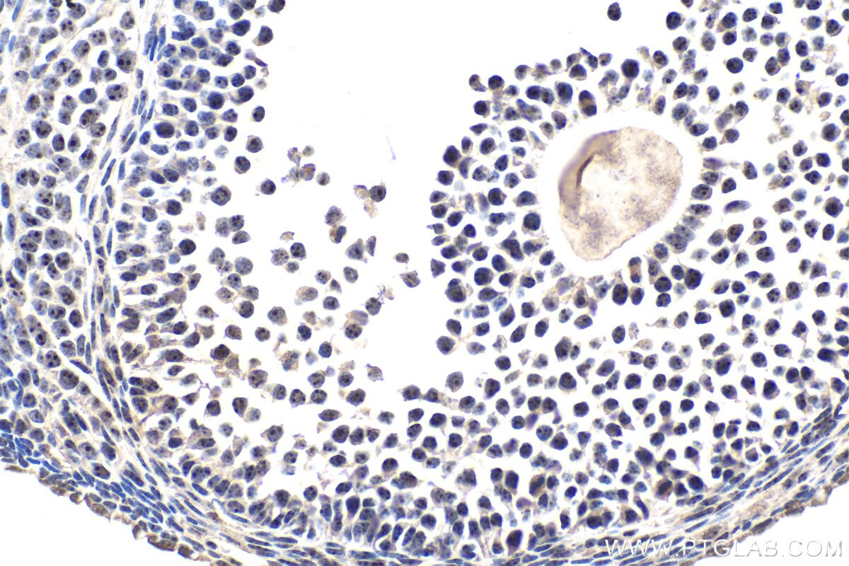 IHC staining of mouse ovary using 30227-1-AP Immunohistochemistry (IHC) staining of mouse ovary tissue using WDR43 Polyclonal antibody (30227-1-AP)