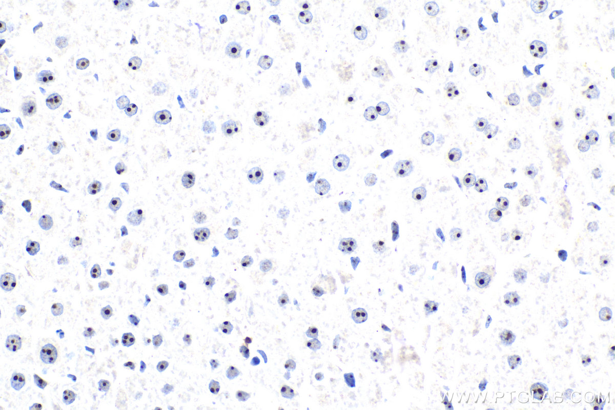 IHC staining of rat liver using 30227-1-AP Immunohistochemistry (IHC) staining of rat liver tissue using WDR43 Polyclonal antibody (30227-1-AP)