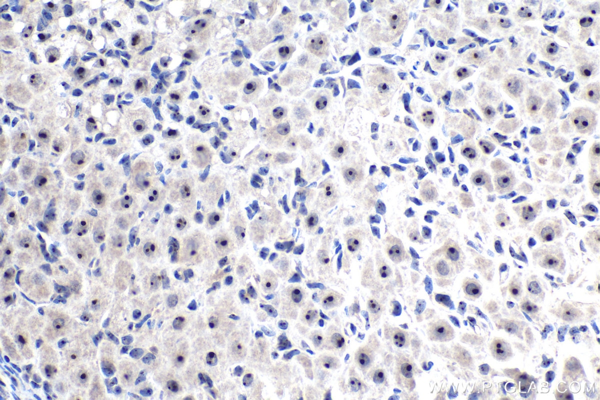 IHC staining of rat ovary using 30227-1-AP Immunohistochemistry (IHC) staining of rat ovary tissue using WDR43 Polyclonal antibody (30227-1-AP)