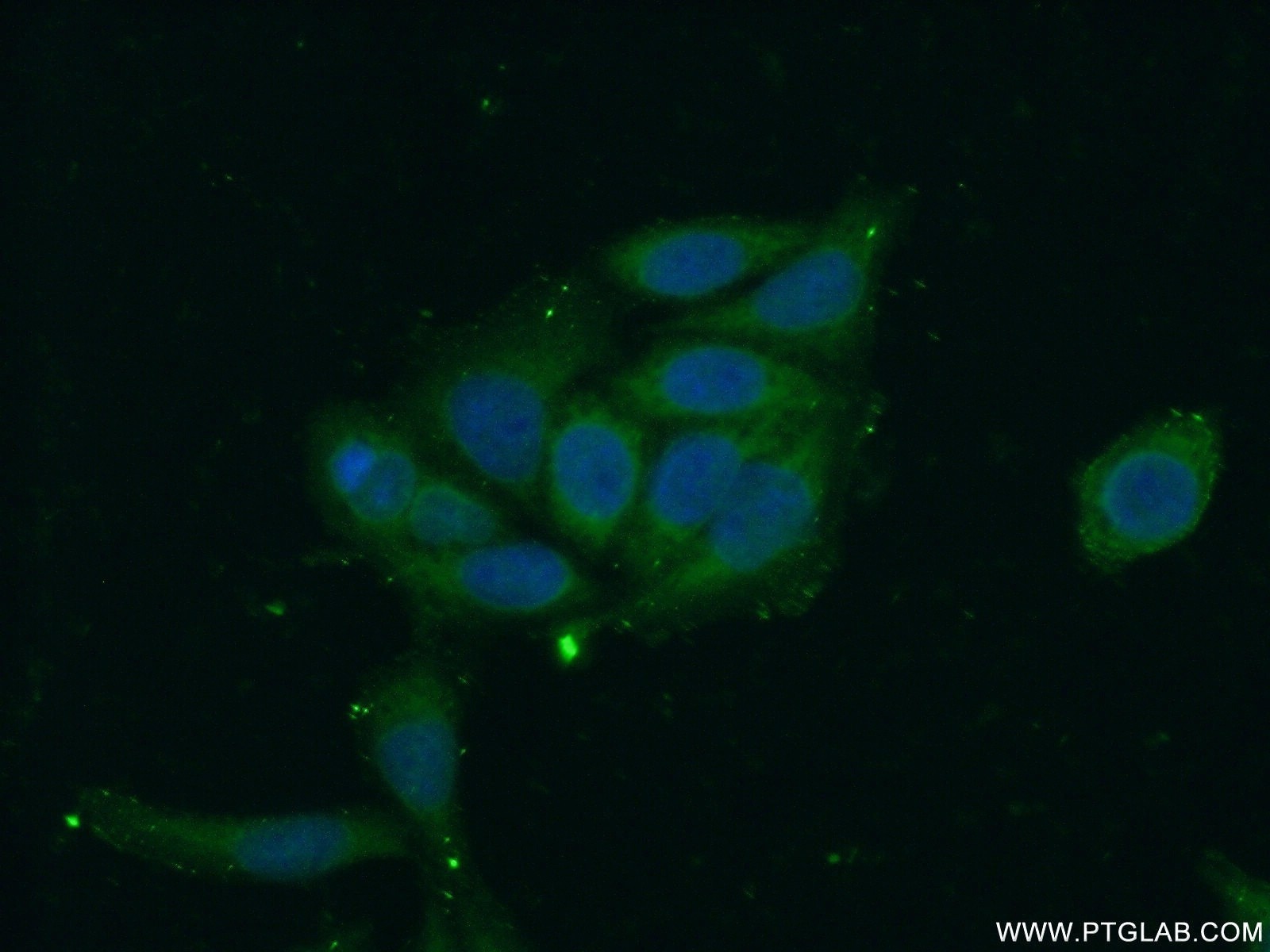 Immunofluorescence (IF) / fluorescent staining of HeLa cells using WDR45/WIPI4 Polyclonal antibody (19194-1-AP)