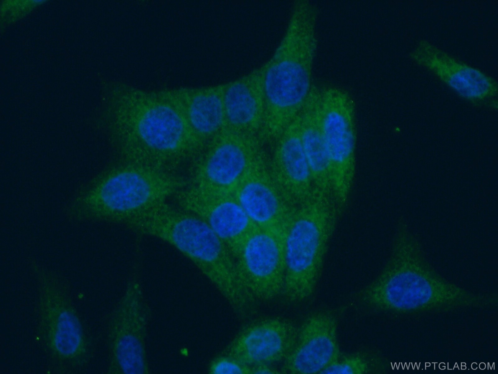 Immunofluorescence (IF) / fluorescent staining of HeLa cells using WDR45/WIPI4 Polyclonal antibody (19194-1-AP)