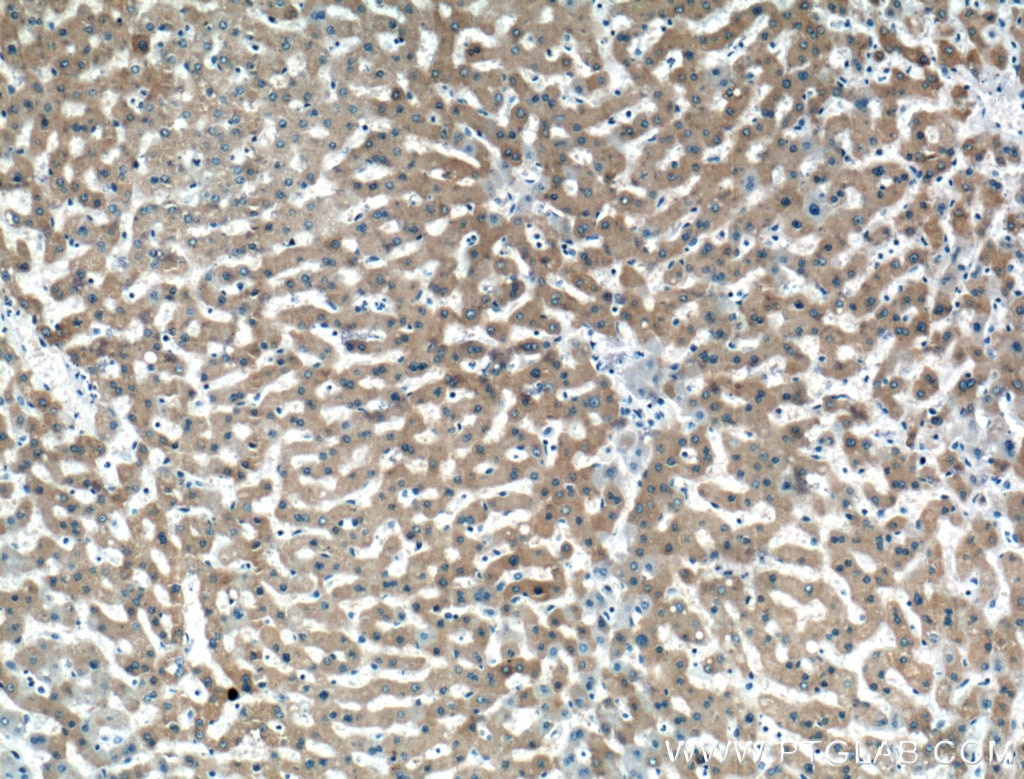 Immunohistochemistry (IHC) staining of human liver tissue using WDR45/WIPI4 Polyclonal antibody (19194-1-AP)