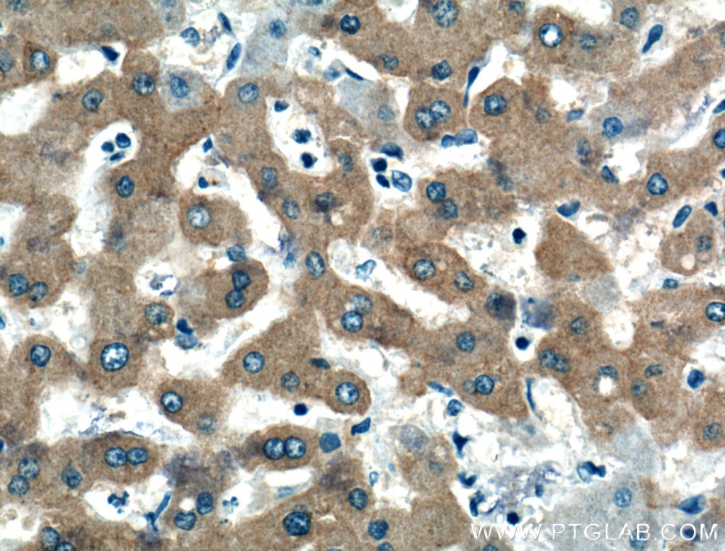 Immunohistochemistry (IHC) staining of human liver tissue using WDR45/WIPI4 Polyclonal antibody (19194-1-AP)