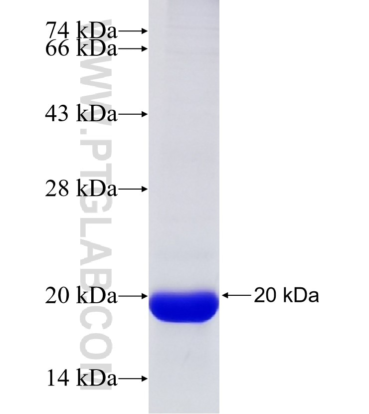 WDR45L fusion protein Ag32904 SDS-PAGE