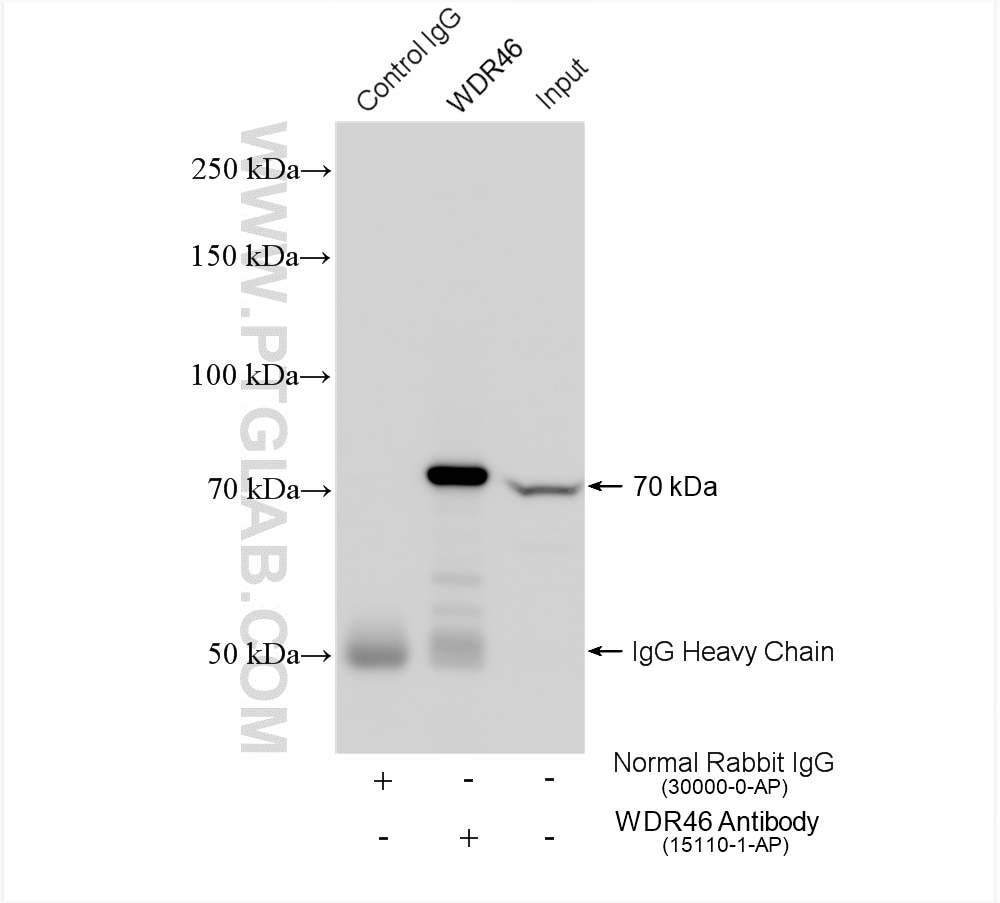 Immunoprecipitation (IP) experiment of Jurkat cells using WDR46 Polyclonal antibody (15110-1-AP)