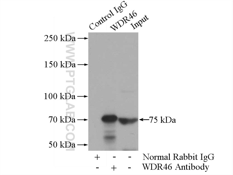 Immunoprecipitation (IP) experiment of Jurkat cells using WDR46 Polyclonal antibody (15110-1-AP)