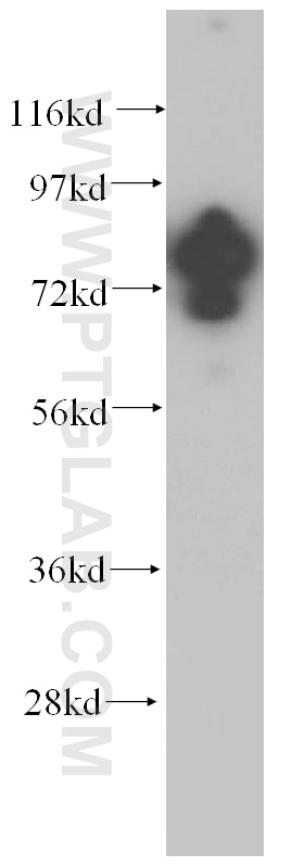 Western Blot (WB) analysis of HeLa cells using WDR46 Polyclonal antibody (15110-1-AP)