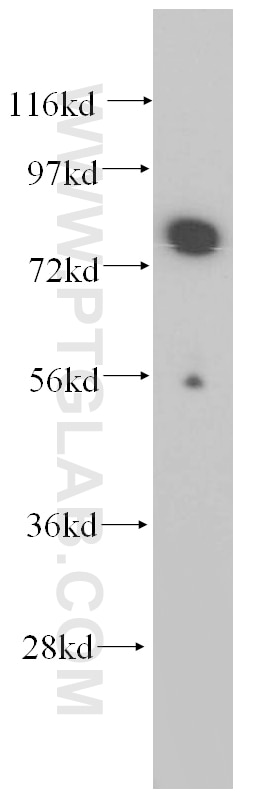 Western Blot (WB) analysis of Jurkat cells using WDR46 Polyclonal antibody (15110-1-AP)