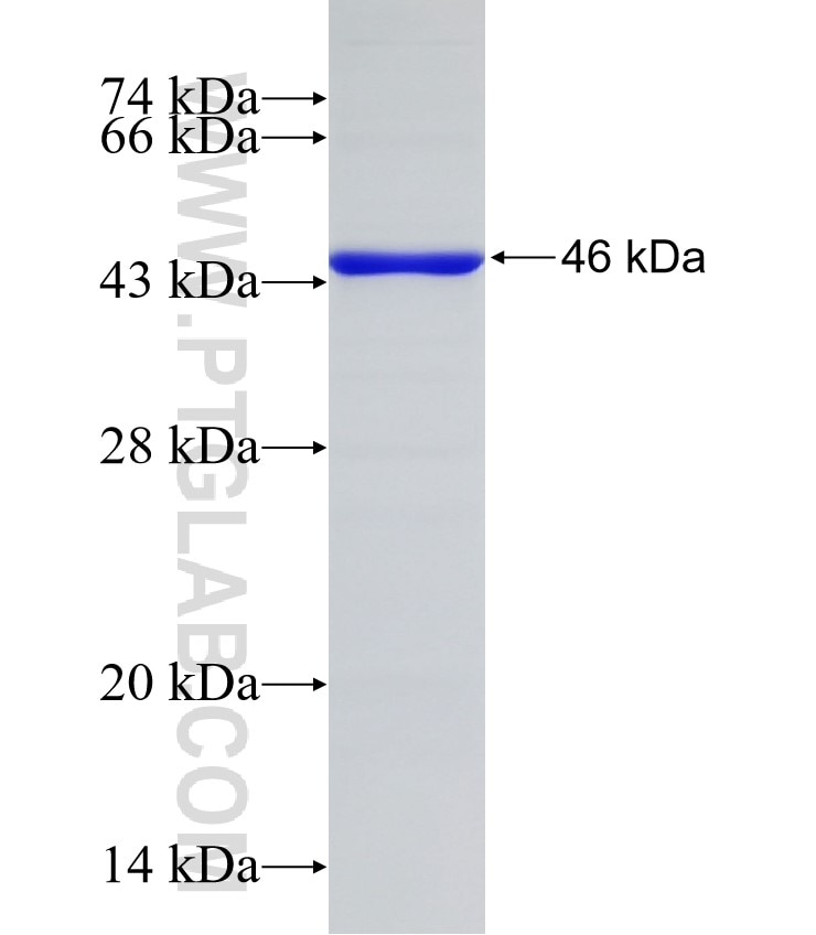 WDR46 fusion protein Ag31723 SDS-PAGE WDR46 fusion protein Ag31723 SDS-PAGE