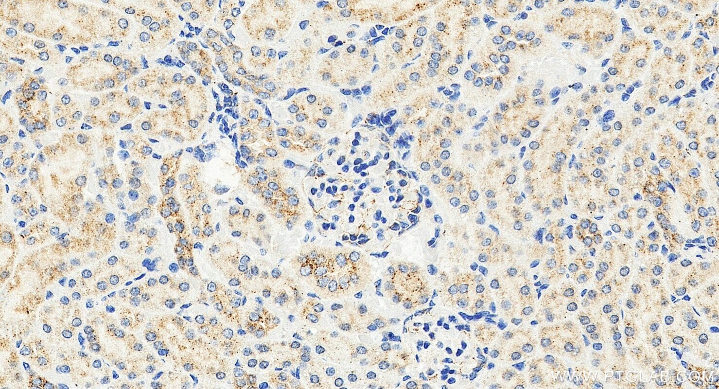 Immunohistochemistry (IHC) staining of mouse kidney tissue using WDR47 Polyclonal antibody (29364-1-AP)