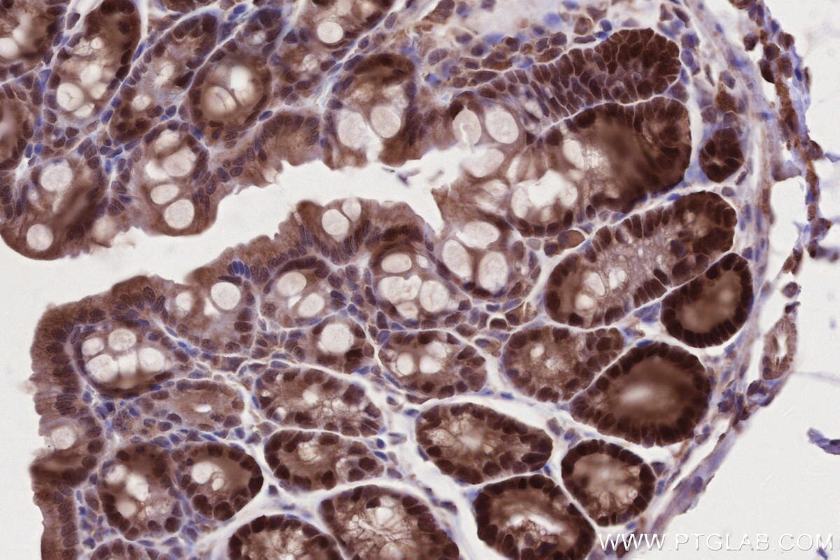 Immunohistochemistry (IHC) staining of mouse colon tissue using WDR48 Polyclonal antibody (16503-1-AP)