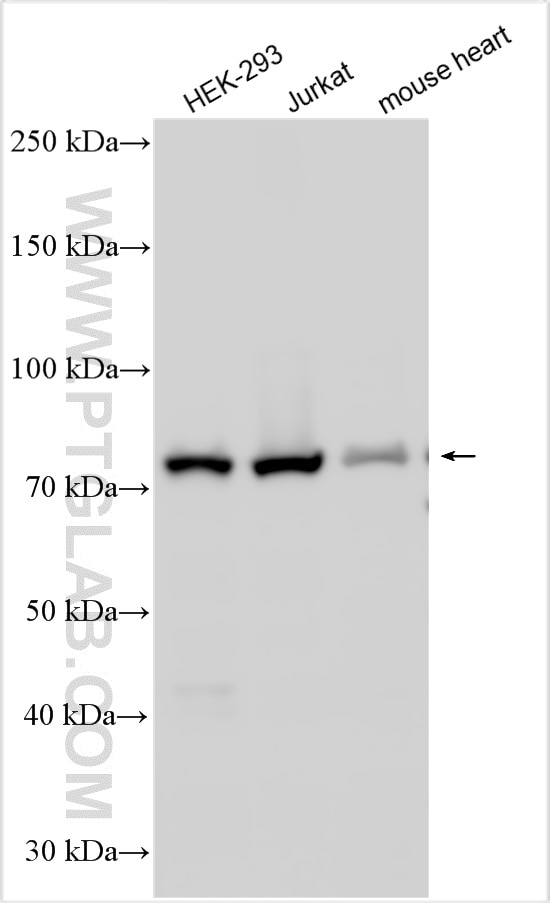 Western Blot (WB) analysis of various lysates using WDR48 Polyclonal antibody (16503-1-AP)
