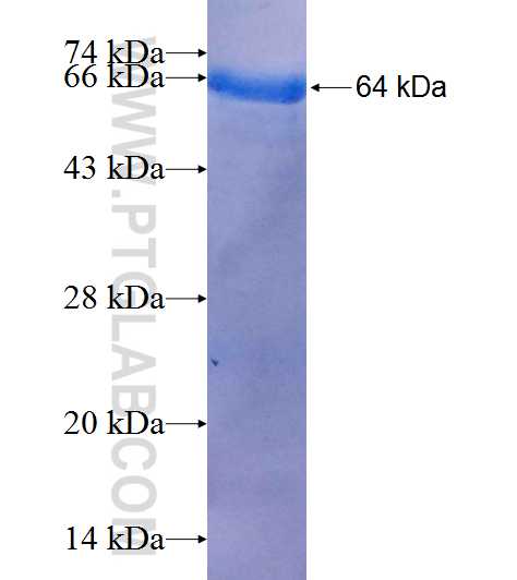 WDR48 fusion protein Ag9674 SDS-PAGE