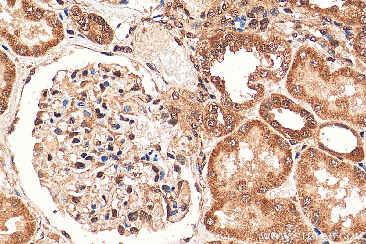 IHC staining of human kidney using 15544-1-AP