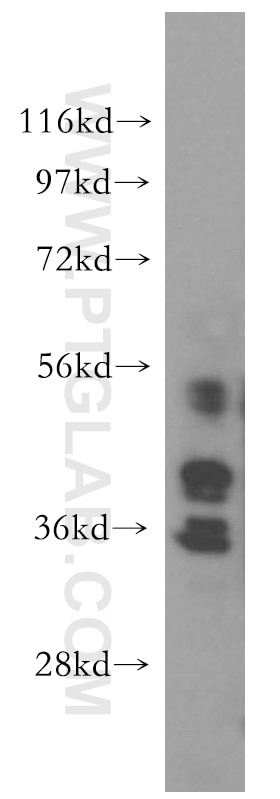 WDR5 Polyclonal antibody