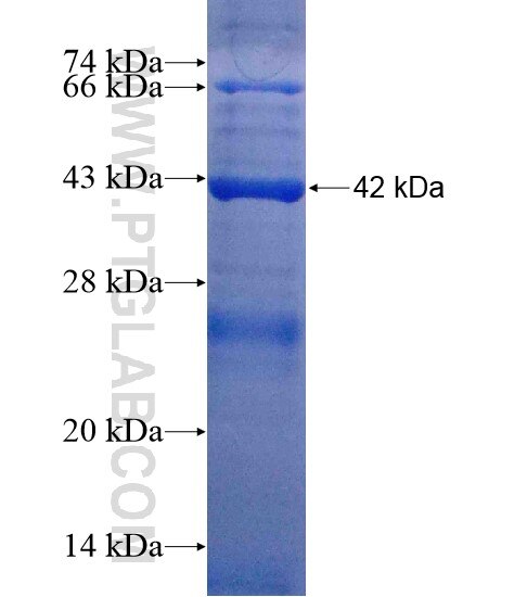 WDR51A fusion protein Ag20156 SDS-PAGE