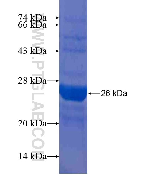 WDR51B fusion protein Ag20200 SDS-PAGE