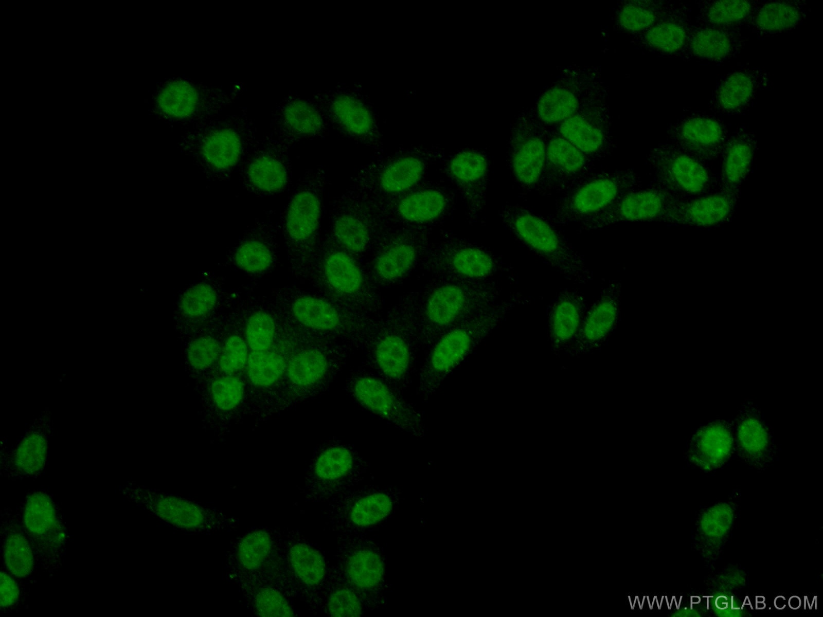 Immunofluorescence (IF) / fluorescent staining of HepG2 cells using WDR55 Polyclonal antibody (20786-1-AP)