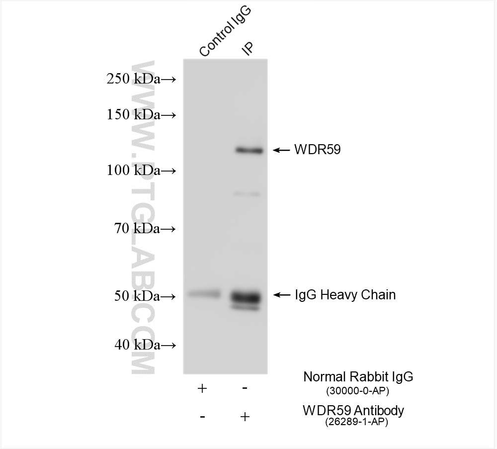 WDR59