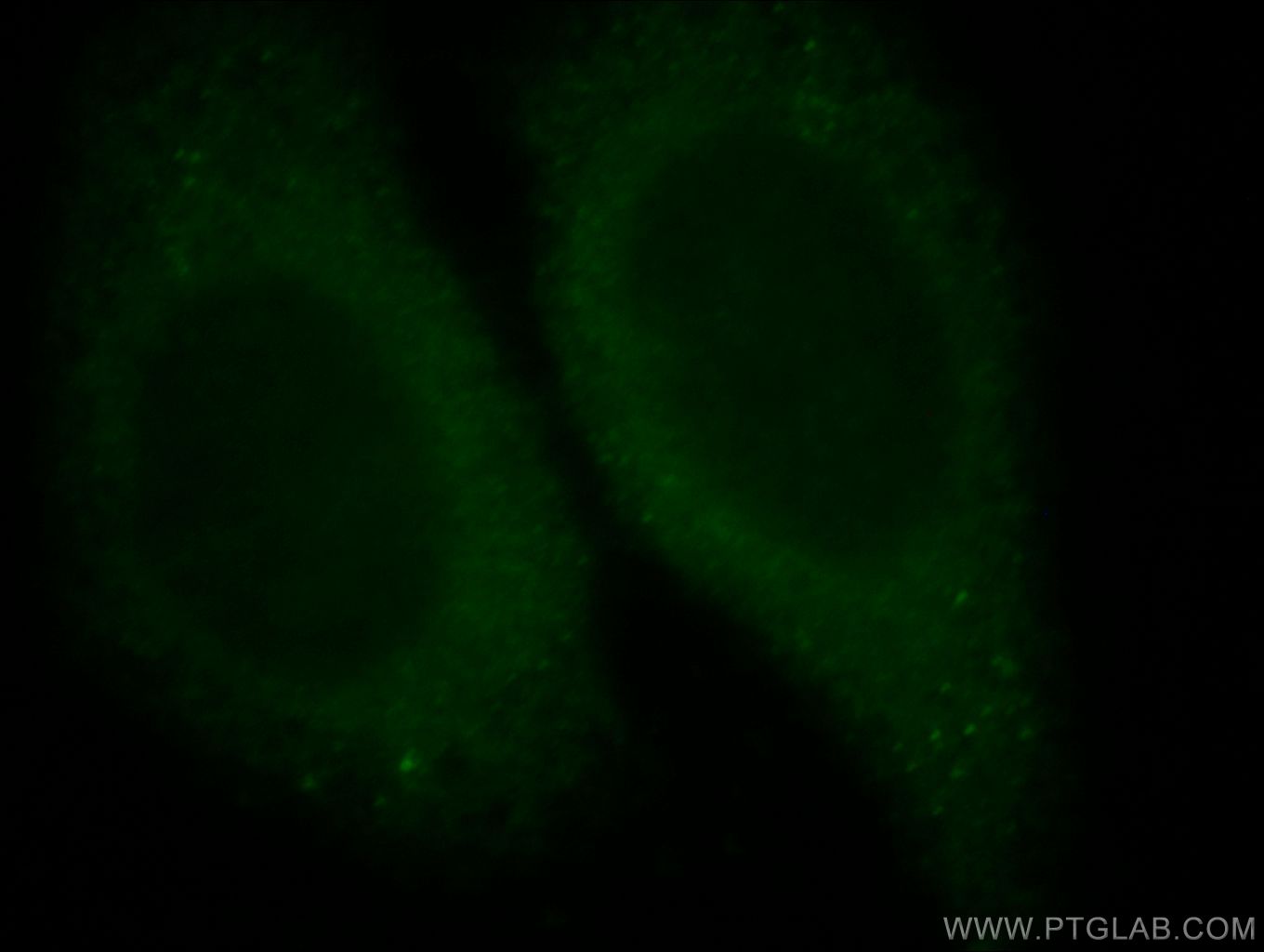 Immunofluorescence (IF) / fluorescent staining of HepG2 cells using WDR6 Polyclonal antibody (20508-1-AP)