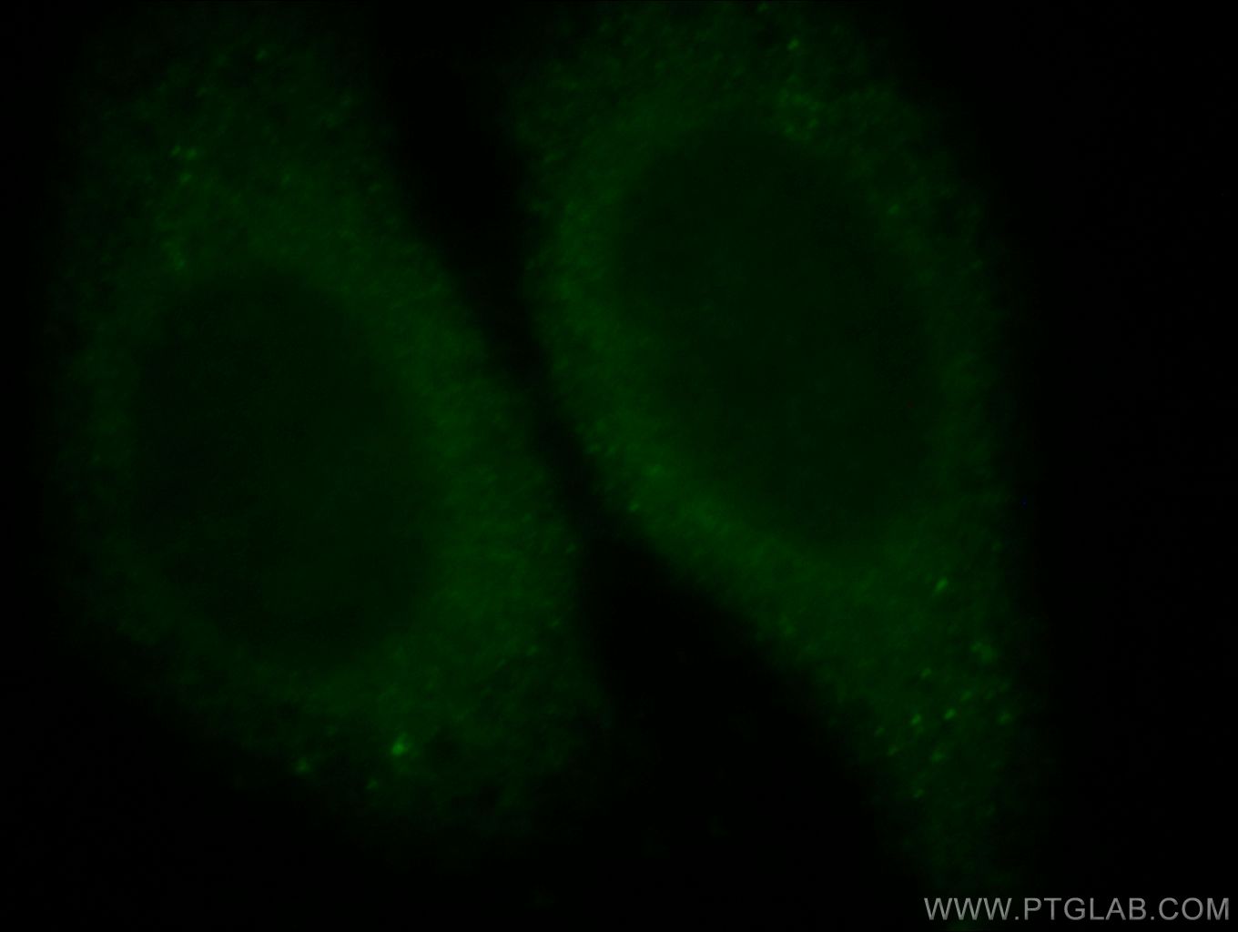 IF Staining of HepG2 using 20508-1-AP