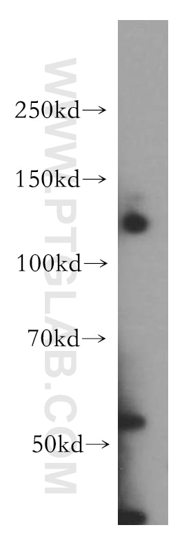 Western Blot (WB) analysis of HeLa cells using WDR6 Polyclonal antibody (20508-1-AP)