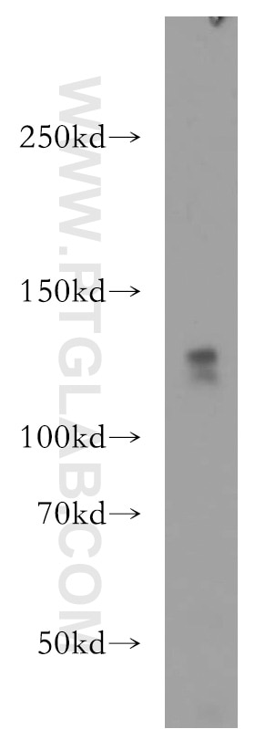 Western Blot (WB) analysis of HeLa cells using WDR6 Polyclonal antibody (20508-1-AP)