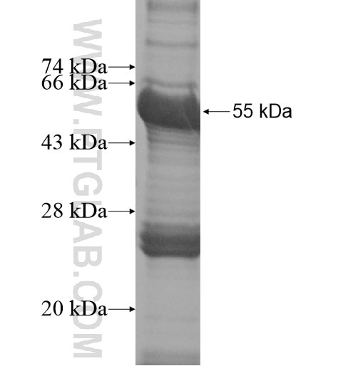 WDR6 fusion protein Ag14316 SDS-PAGE