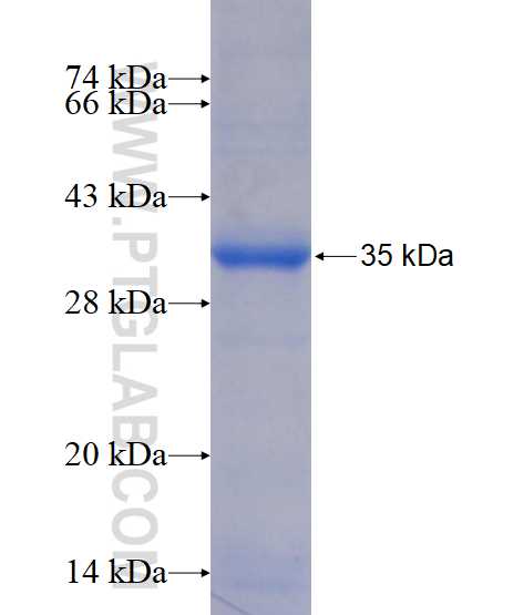 WDR6 fusion protein Ag14375 SDS-PAGE