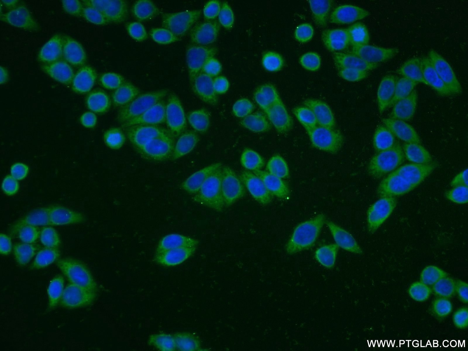 Immunofluorescence (IF) / fluorescent staining of HeLa cells using WDR61 Polyclonal antibody (22536-1-AP)