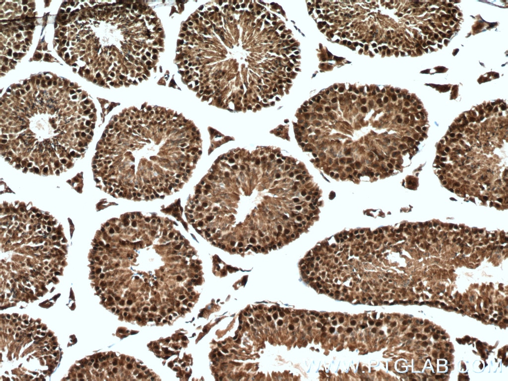 Immunohistochemistry (IHC) staining of mouse testis tissue using WDR61 Polyclonal antibody (22536-1-AP)