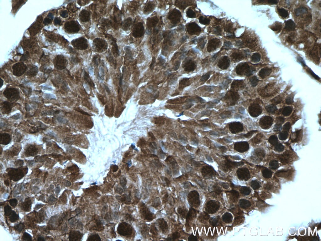 Immunohistochemistry (IHC) staining of mouse testis tissue using WDR61 Polyclonal antibody (22536-1-AP)